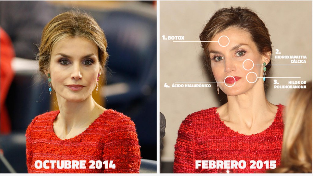 Fotos del antes y después de la Reina Letizia 
