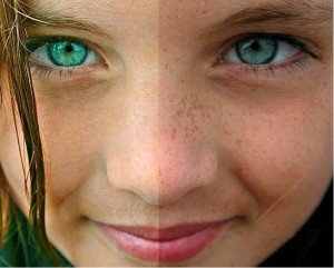 Mujer antes y después de usar cremas para aclarar la piel 