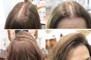antes y después de espesores de cabello 